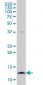 CSTB / Cystatin B / Stefin B Antibody (clone M2F1)
